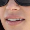 SS-Lana